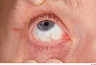 Stanley Johnson eye 0010.jpg